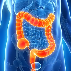 Colitis រលាកពោះវៀនធំ