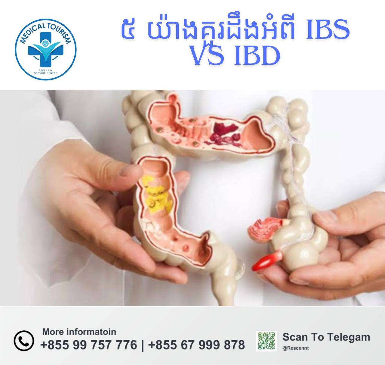 IBS vs IBD