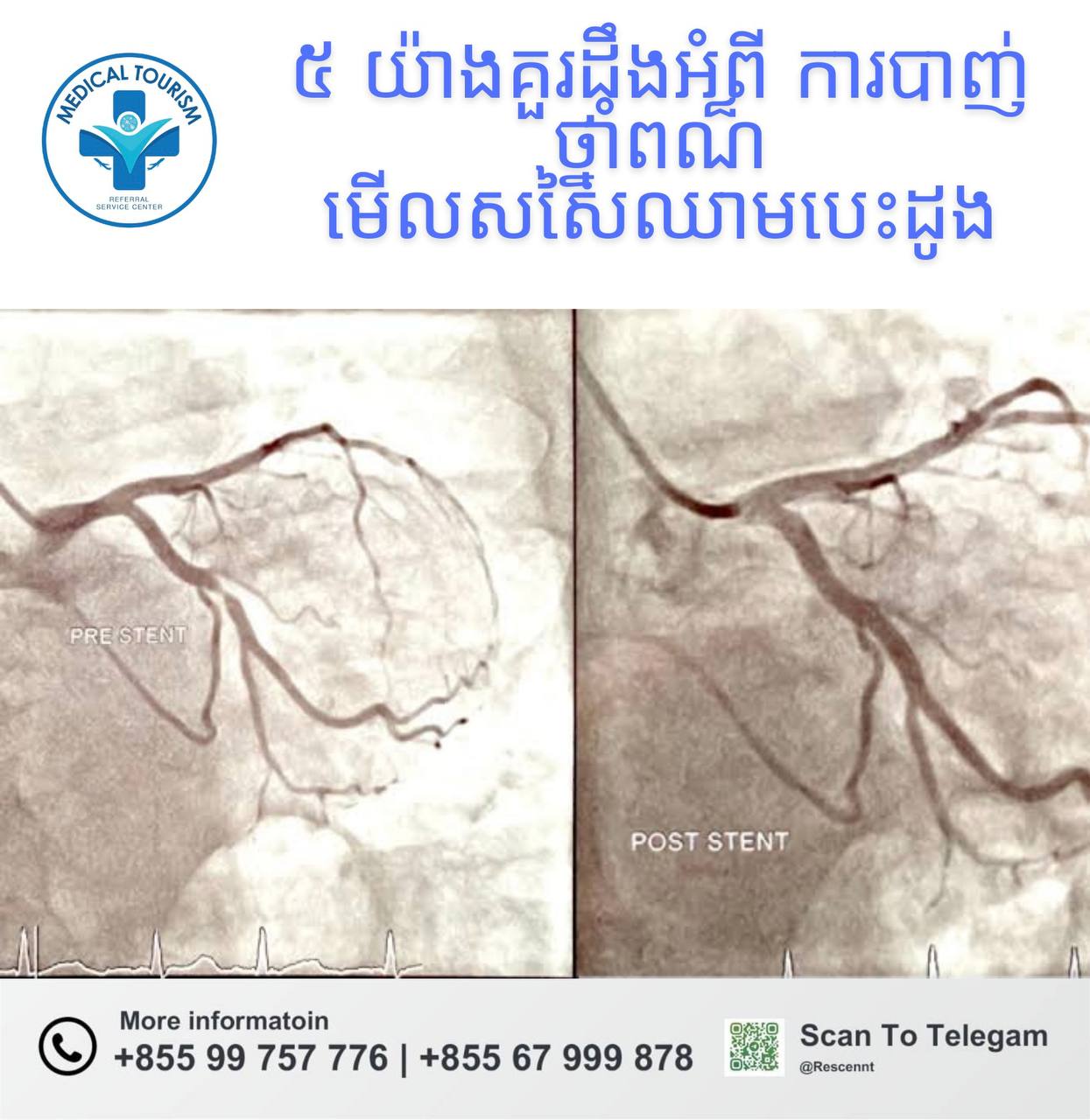 angiogram