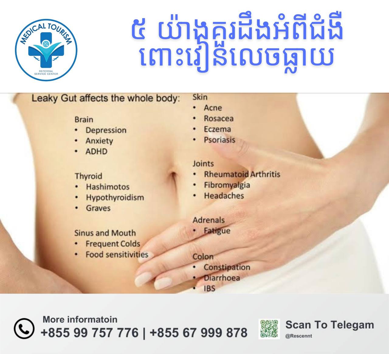 ជំងឺពោះវៀនលេចធ្លាយ