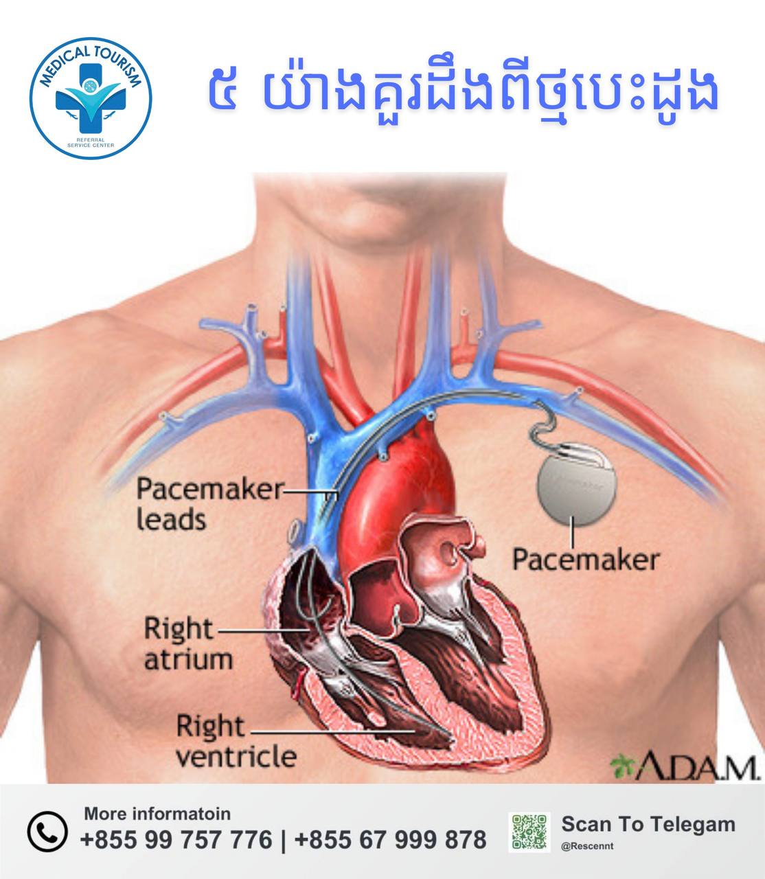 ថ្មបេះដូង