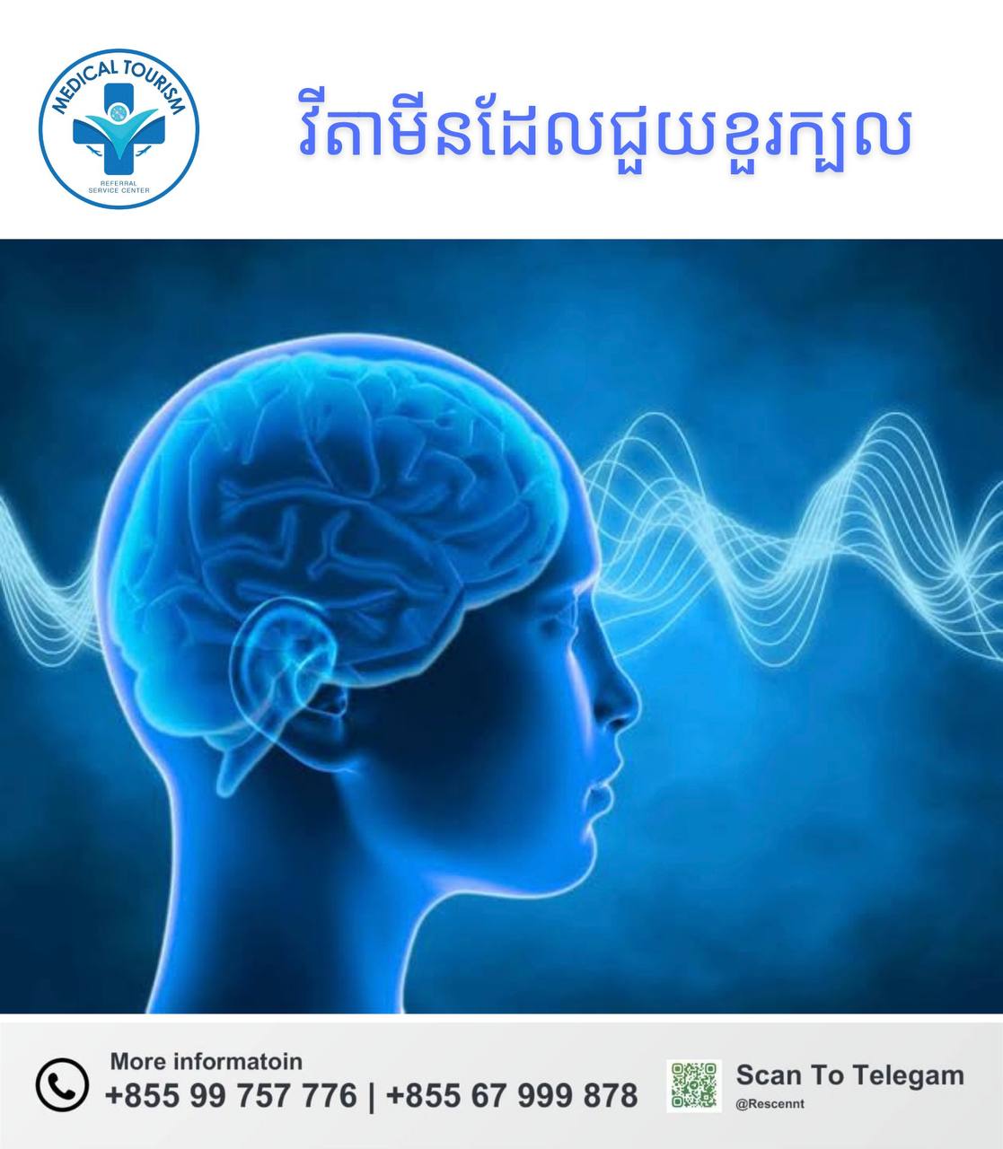 វិតាមីនខួរក្បាល