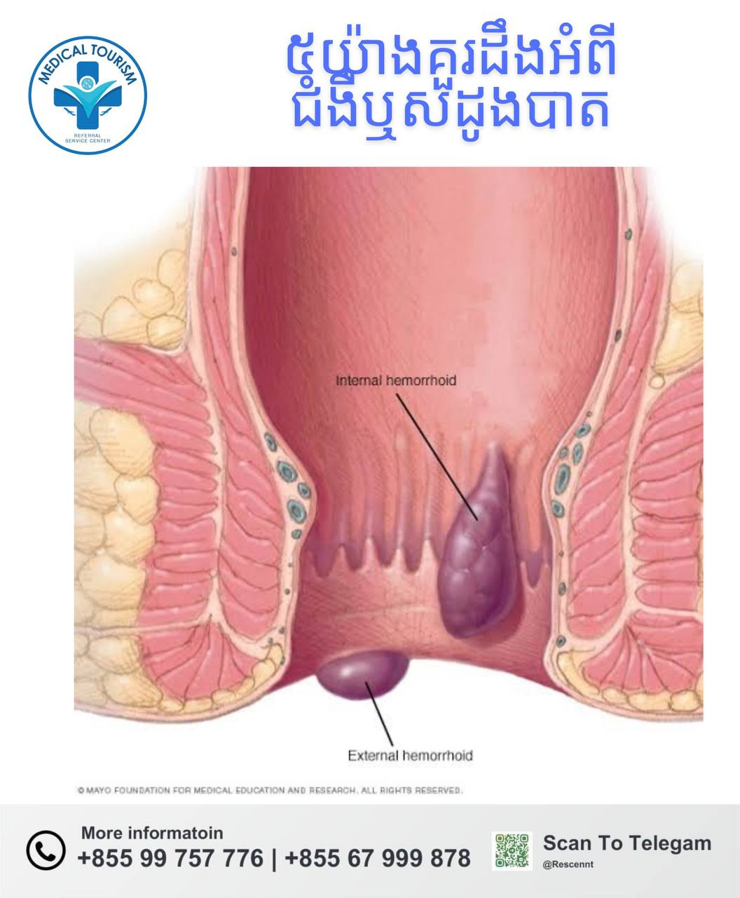 ឬសដូងបាត