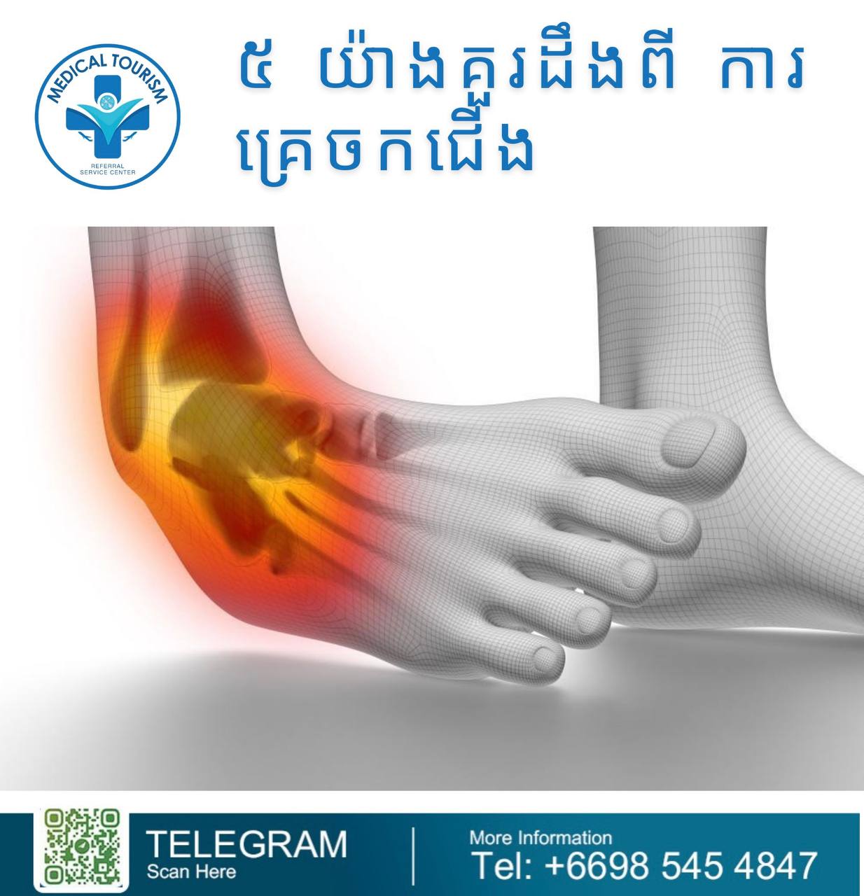 Ankle sprain