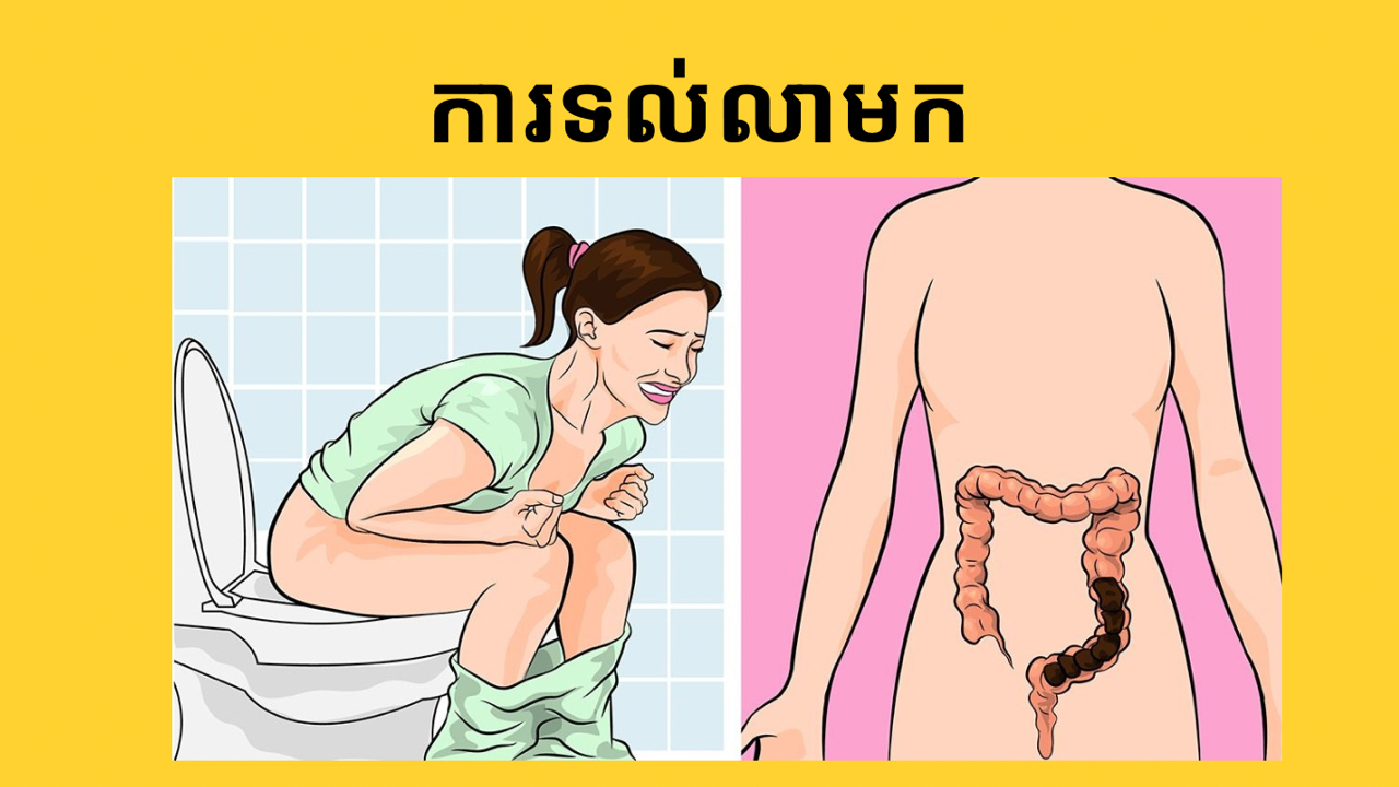 ទល់លាមក