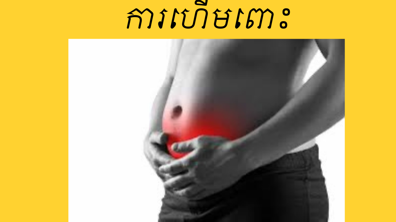 Abdominal bloating